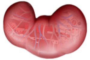 Nephrectomy