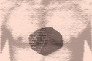 The Rock and the Ripe